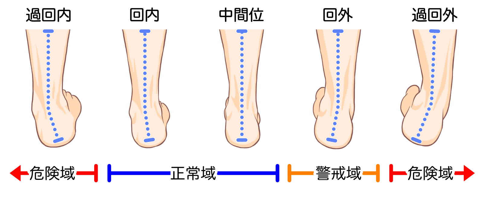 右足を後ろから見た状態です